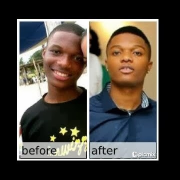 Wizkid-before_and_after.jpg